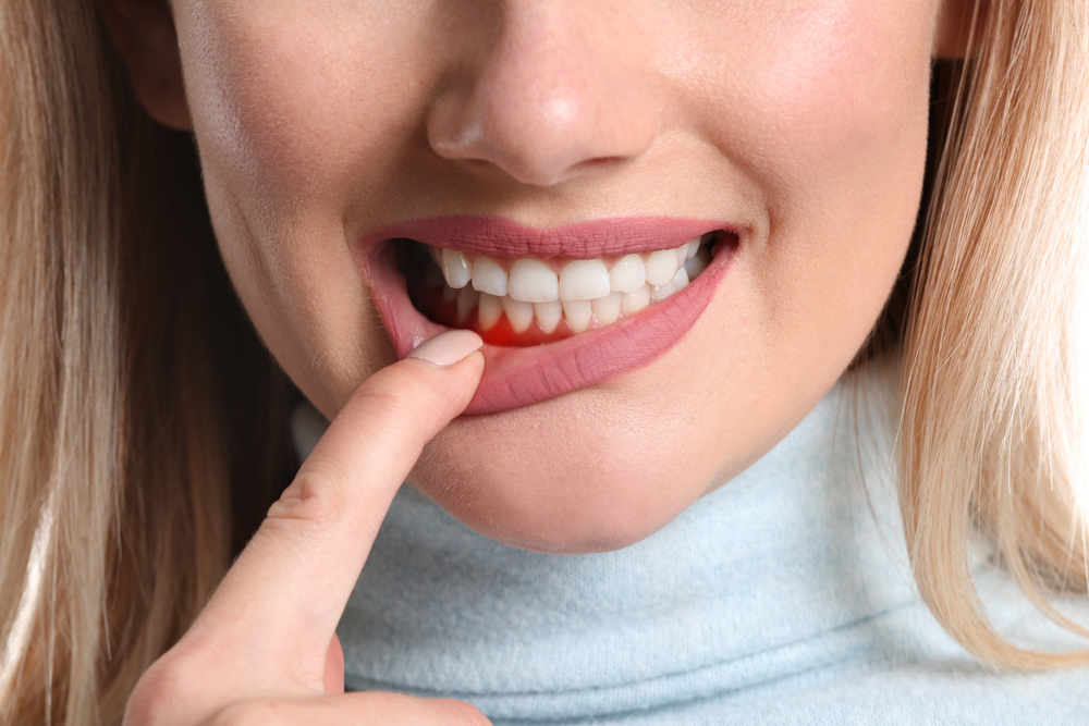 Illustration connecting gum disease to overall health