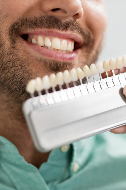 Are Veneers the Right Choice for You?