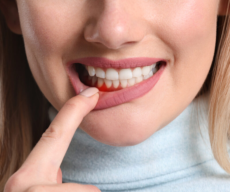 The Link Between Gum Disease And Your Overall Health